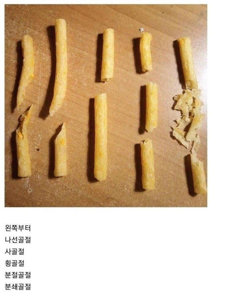 [유머] 과자로 알아보는 골절의 종류