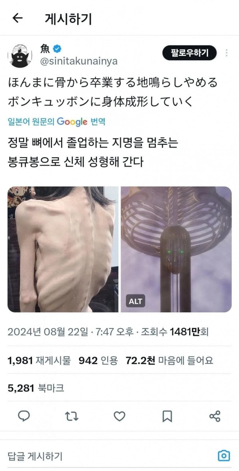 과체중에서 27kg까지 뺀 일본 여성…