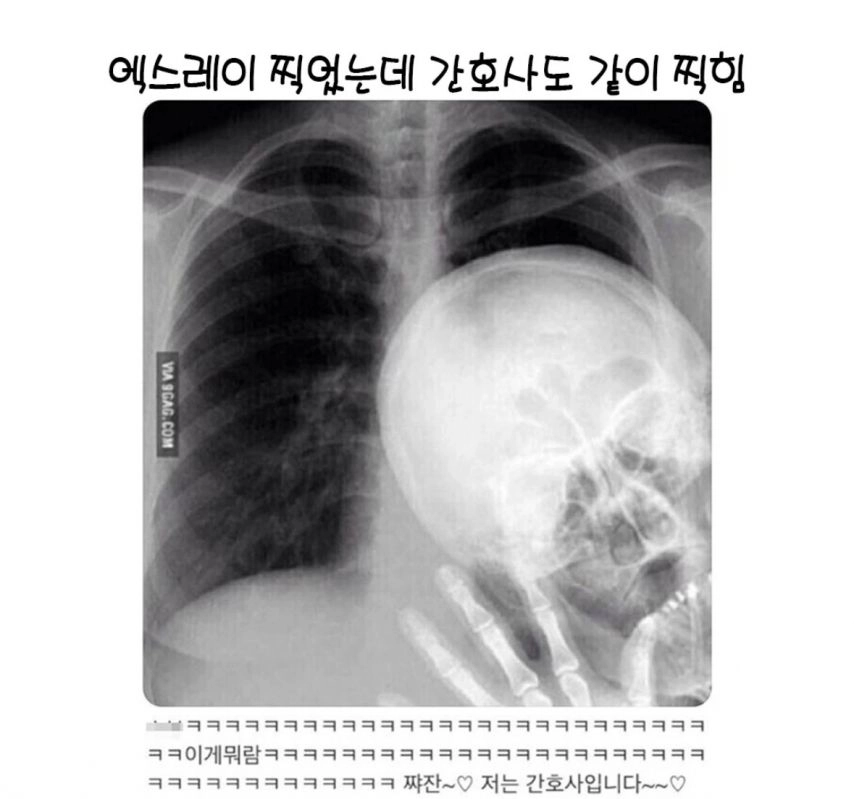 엑스레이 찍었는데 간호사도 같이 찍힘